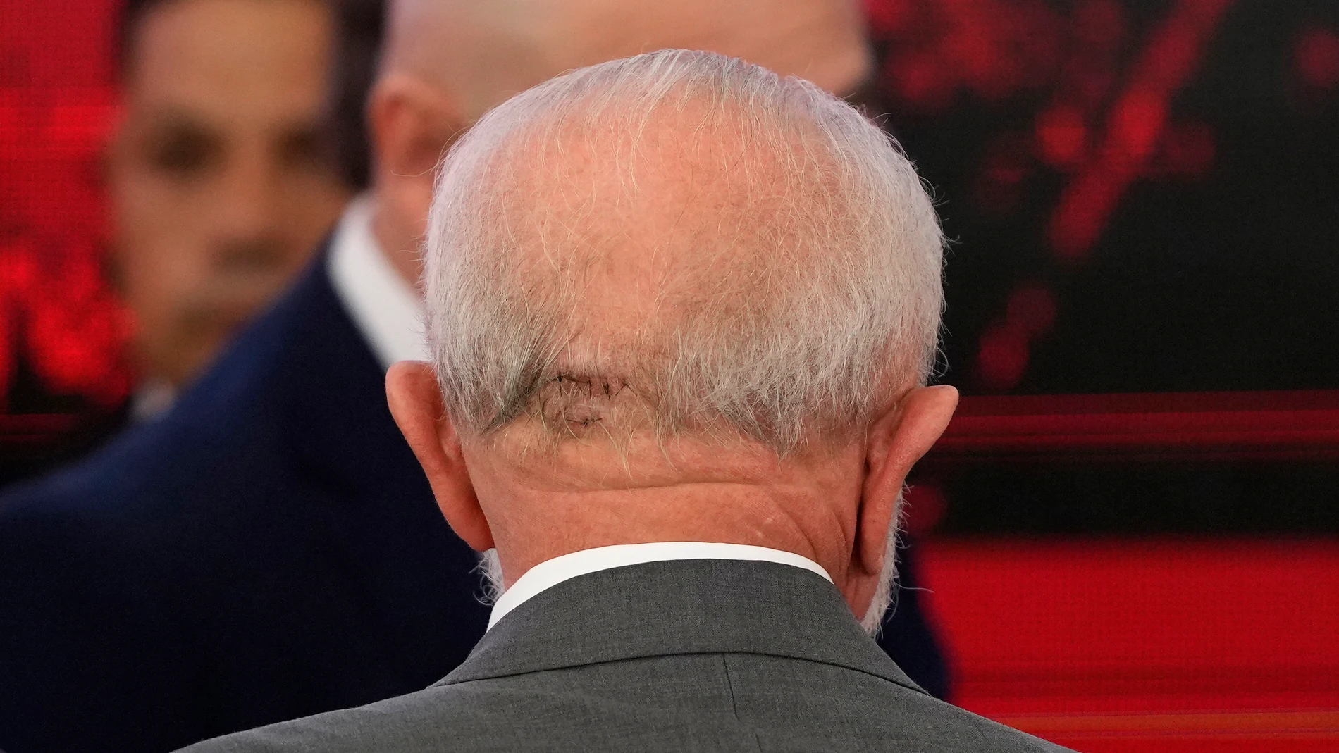 The back of Brazilian President Luiz Inacio Lula da Silva's head shows stitches resulting from a fall, during an event at Planalto Presidential Palace in Brasilia, Brazil, Friday, Oct. 25, 2024. (AP Photo/Eraldo Peres)