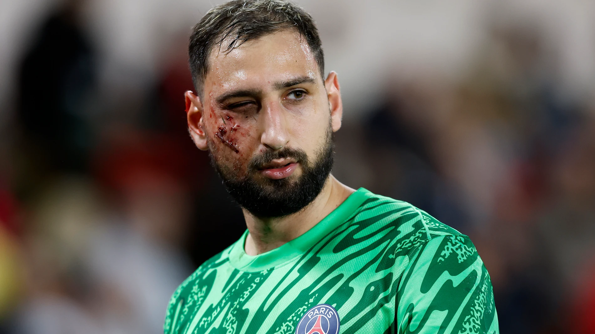 Monaco (Monaco), 18/12/2024.- Goalkeeper Gianluigi Donnarumma of Paris Saint Germain leaves the pitch after receiving an injury during the French Ligue 1 soccer match AS Monaco vs Paris Saint Germain, at Stade Louis II, in Monaco, 18 December 2024. EFE/EPA/SEBASTIEN NOGIER