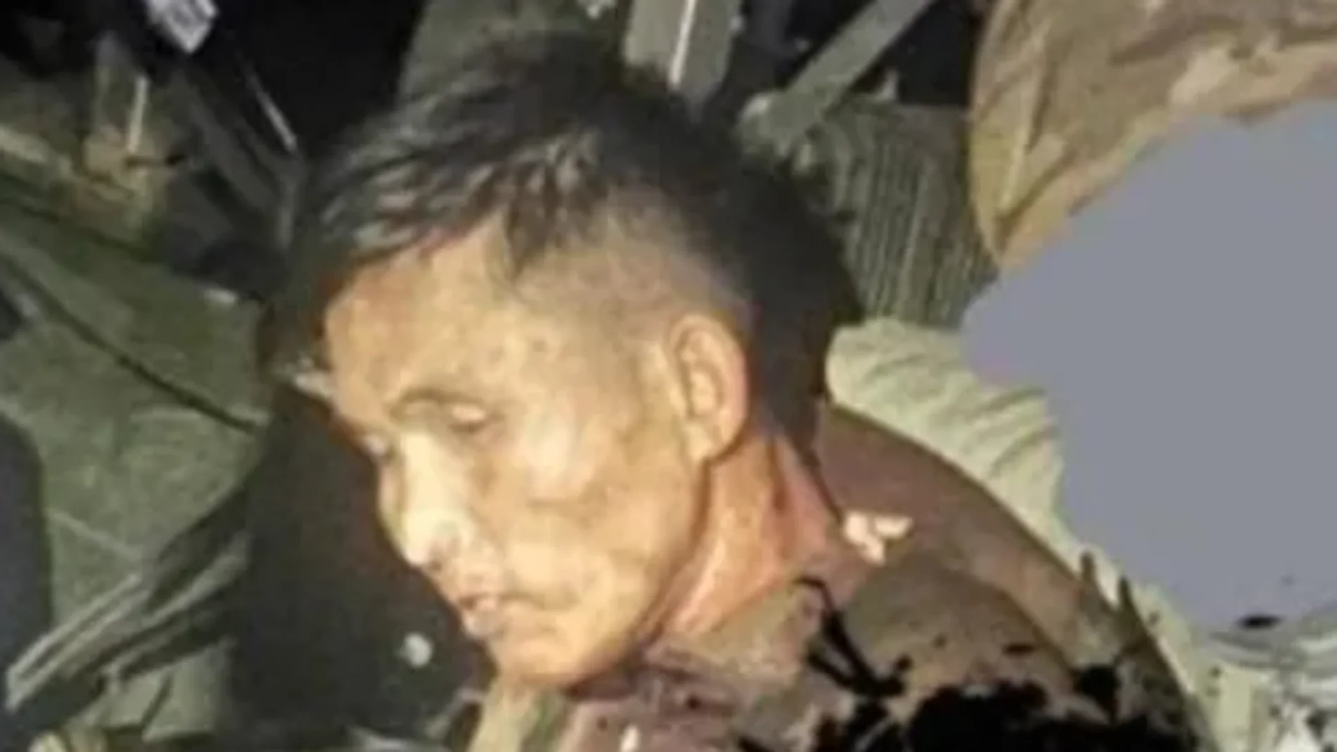 Supuesto soldado norcoreano herido y capturado por Ucrania en la región rusa de Kursk
