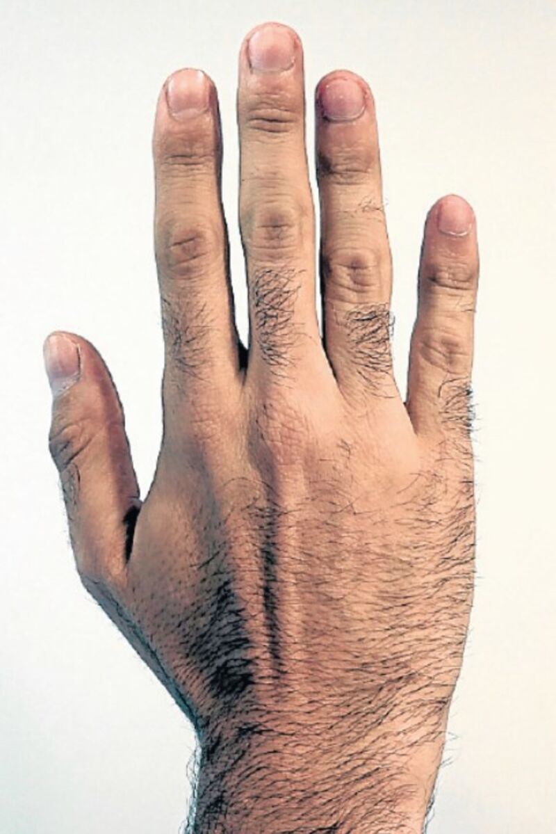 Dedos de la mano