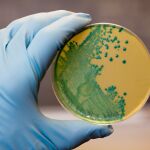 Listeria monocytogenes que crece en una placa de aga