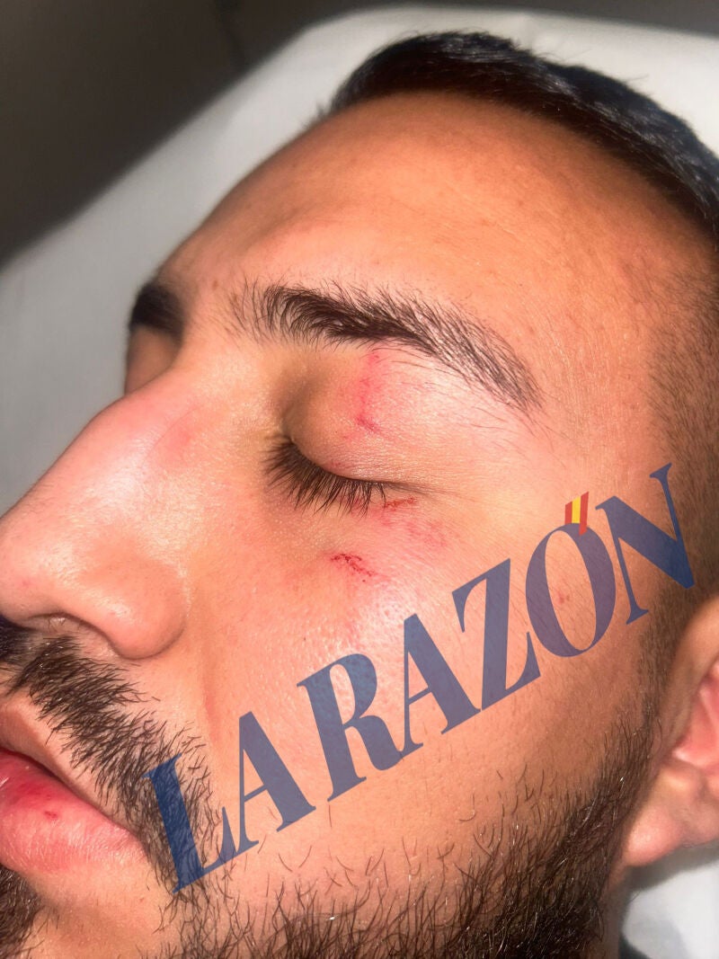 Agresión a un taxista en Barcelona