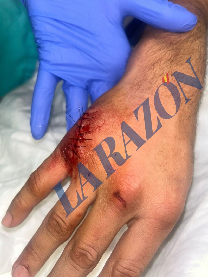 Agresión a un taxista en Barcelona