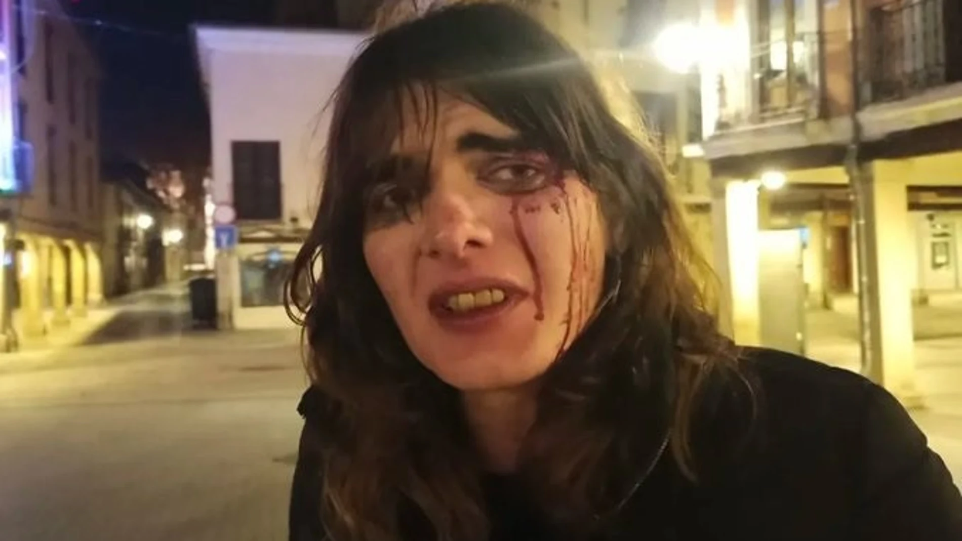 Dos hombres golpean repetidamente a una mujer en una agresión tránsfoba en pleno centro de AlcaláREMITIDA / HANDOUT por TWITTER DE CARLA ANTONELLIFotografía remitida a medios de comunicación exclusivamente para ilustrar la noticia a la que hace referencia la imagen, y citando la procedencia de la imagen en la firma28/01/2025