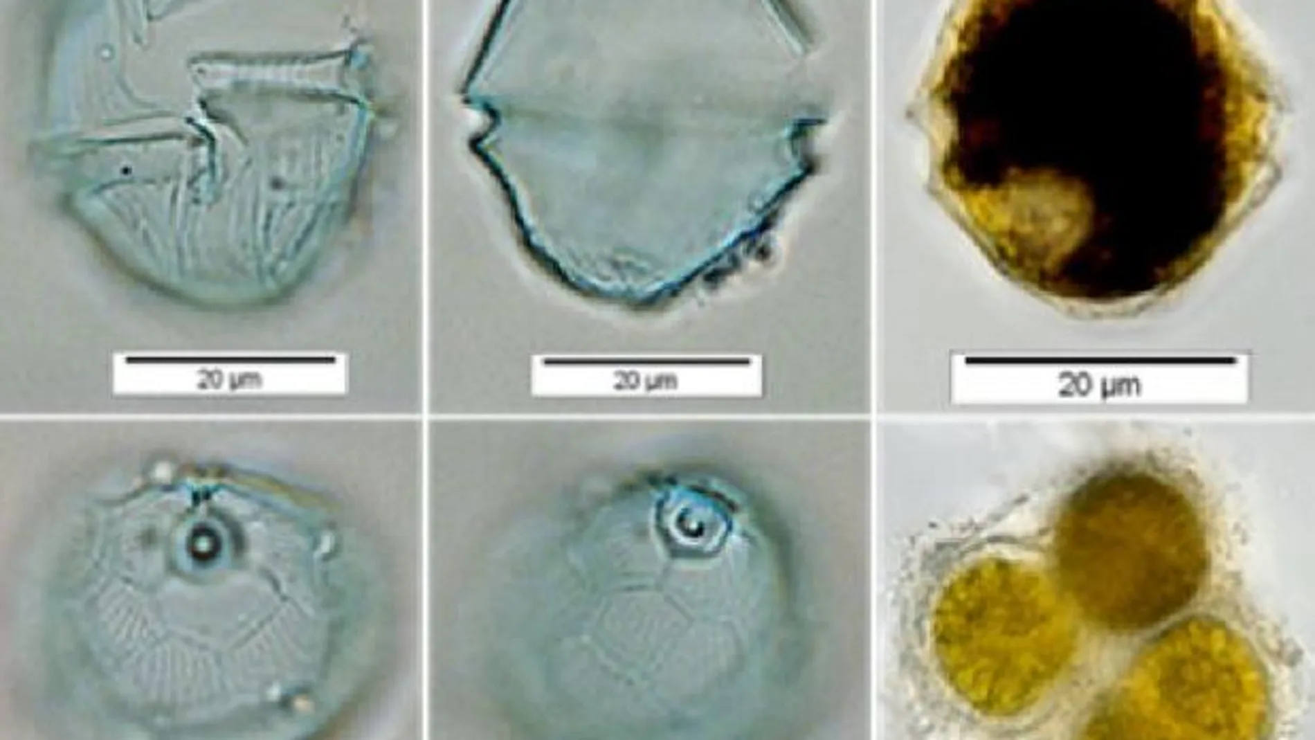 Vulcanodinium rugosum