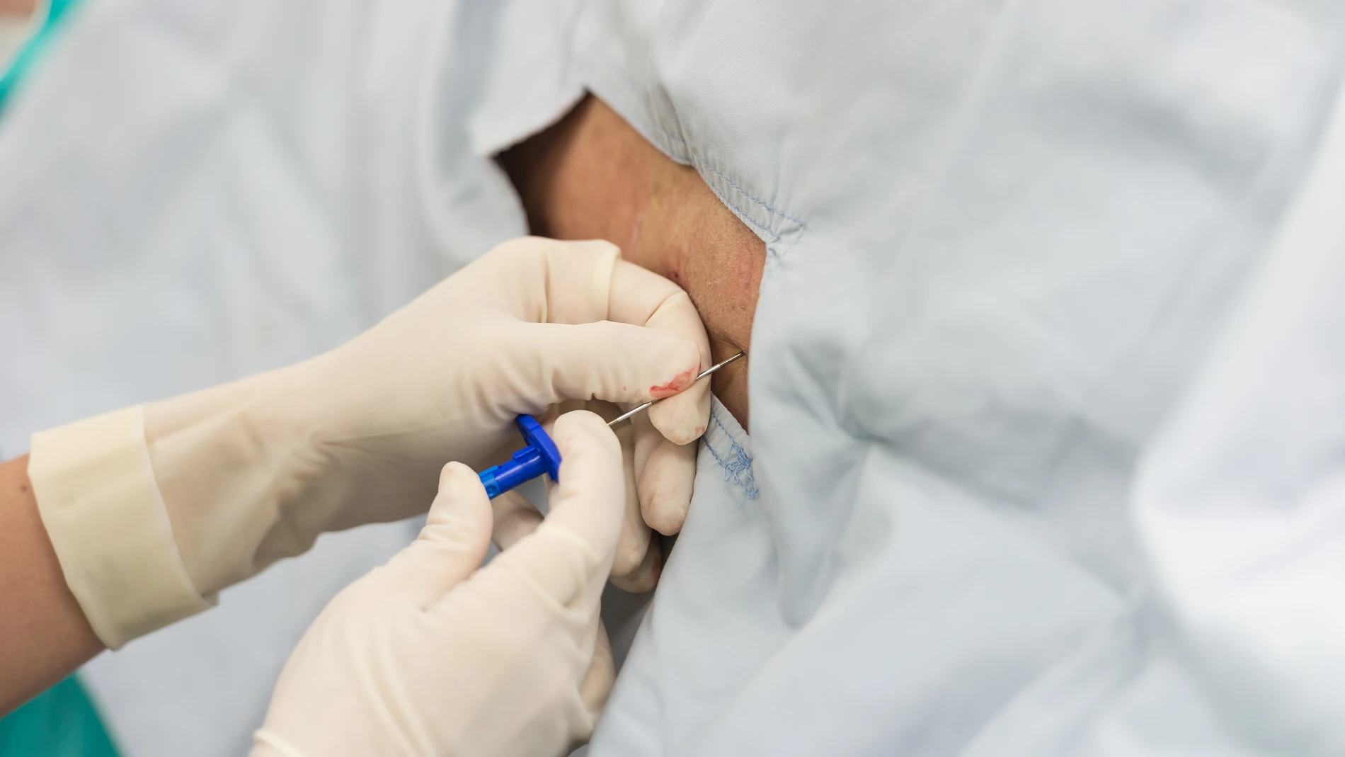 Los expertos ponen en duda si hay que seguir ofreciendo estos tratamientos