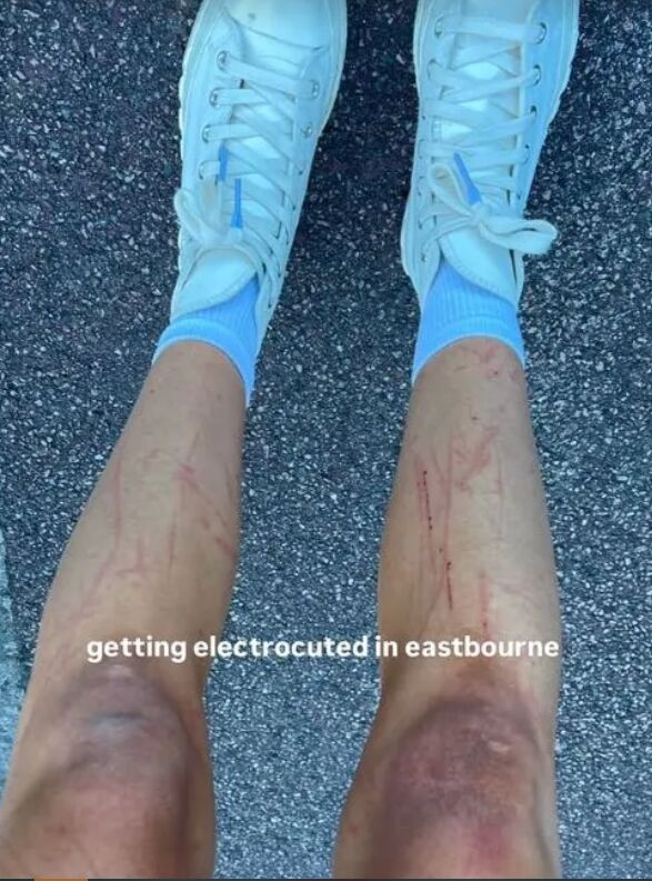 Tras ser electrocutada