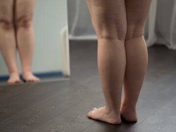 En la obesidad intervienen m&aacute;s factores que la mala alimentaci&oacute;n o el sedentarismo