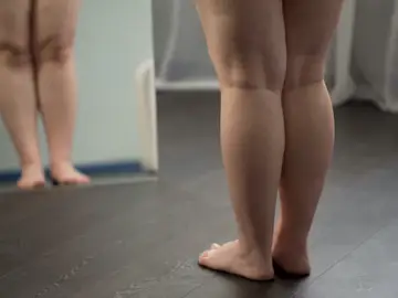 En la obesidad intervienen más factores que la mala alimentación o el sedentarismo En la obesidad intervienen más factores que la mala alimentación o el sedentarismo