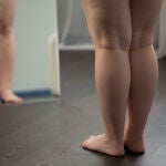 En la obesidad intervienen más factores que la mala alimentación o el sedentarismo