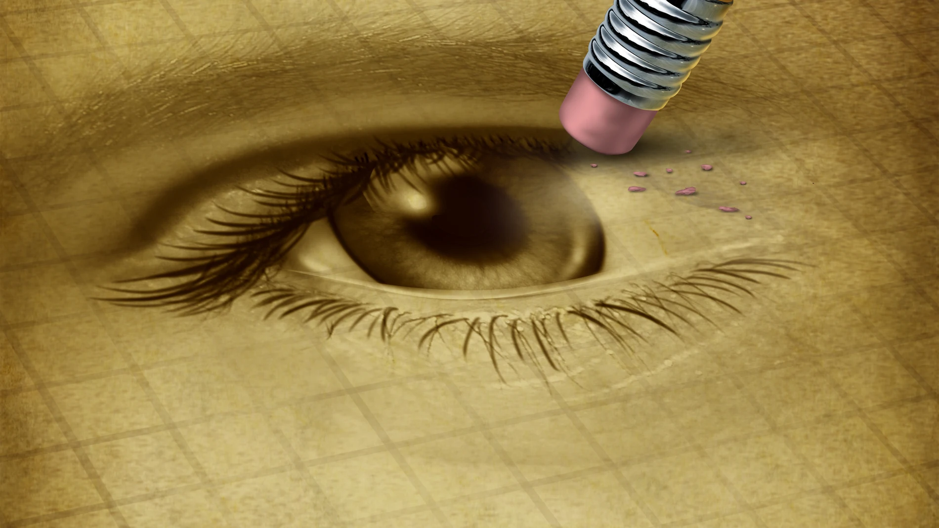 El glaucoma es una enfermedad neurodegenerativa crónica, que produce una pérdida progresiva del campo visual
