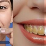 Olvídate de los blanqueamientos caros: estas tiras dejan los dientes blancos en solo 14 días
