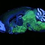 Patrón de expresión de NOVA1 en el cerebro de un ratón. NOVA1 en verde, núcleos (DAPI) en azul.