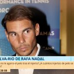 ¿Por qué a Rafa Nadal no le funcionan los tratamientos anticalvicie? Un especialista aclara el motivo en 'TardeAR'