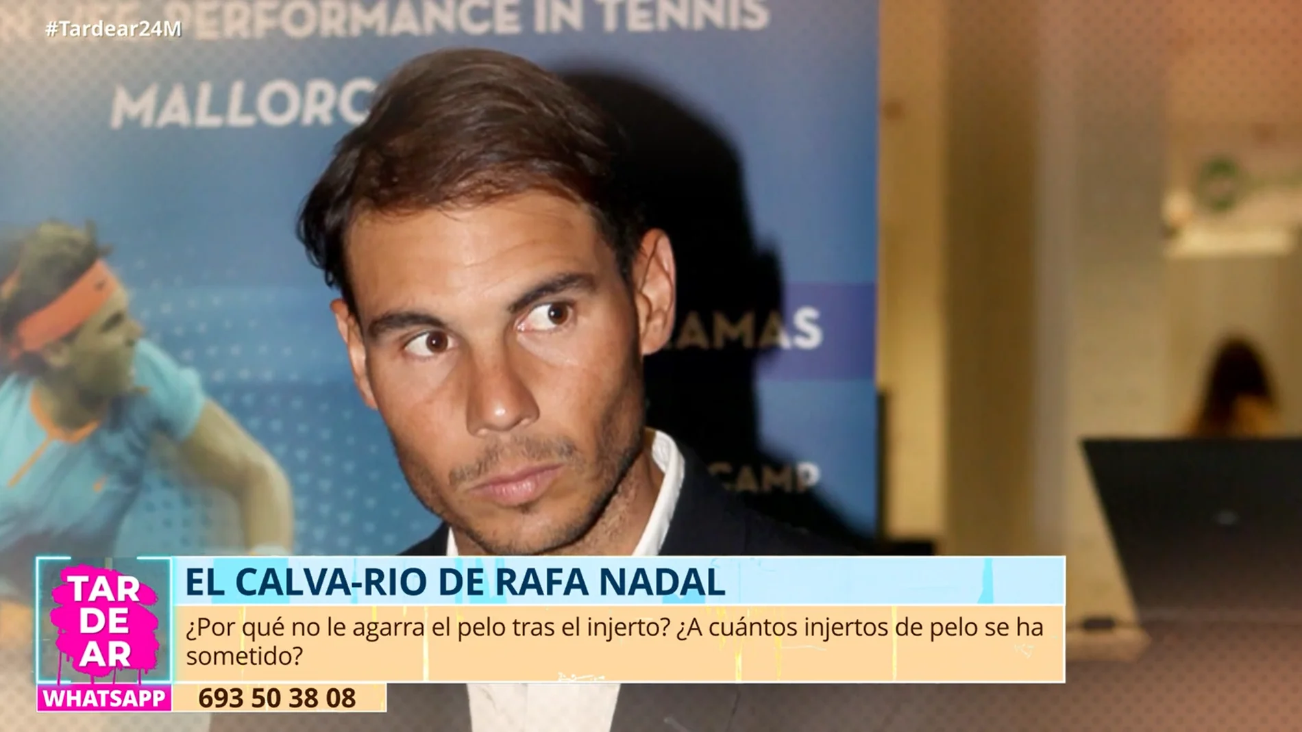 ¿Por qué a Rafa Nadal no le funcionan los tratamientos anticalvicie? Un especialista aclara el motivo en 'TardeAR'