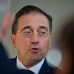 El ministro Albares cree que no hay que asustar a la gente con la llegada de la guerra