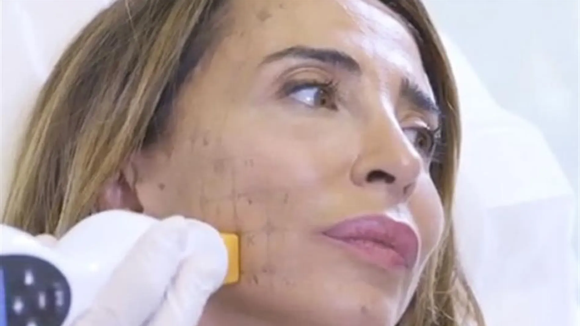 María Patiño sometiéndose a un retoque estético