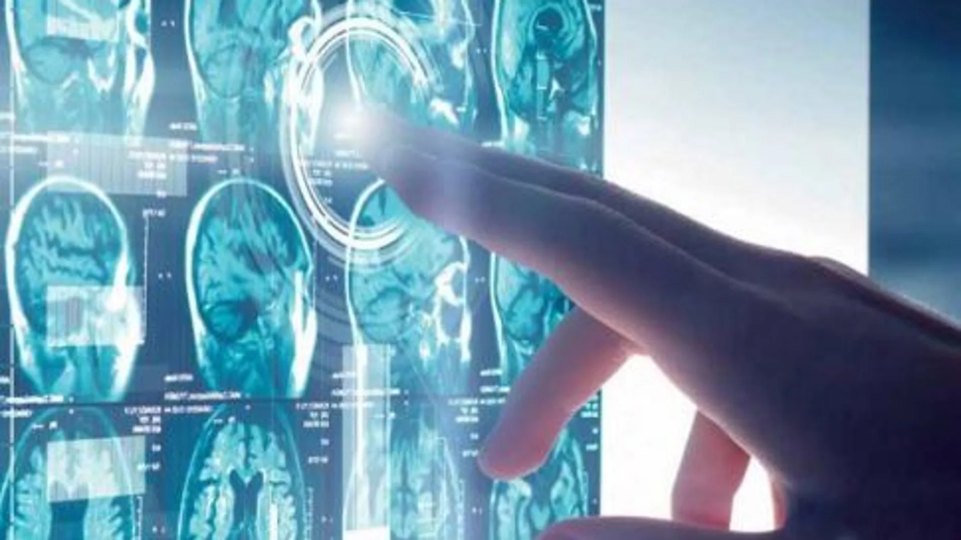 Este hallazgo puede ser clave para el tratamiento del alzhéimer