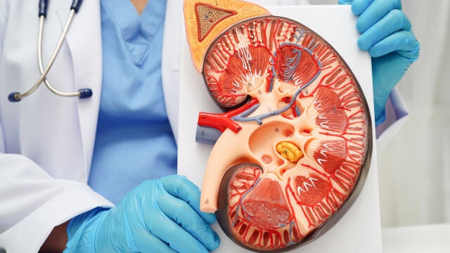 Sanidad activa un 'cribado clave' en mayores de 60 años para detectar la  enfermedad renal crónica