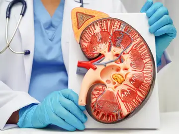El cáncer renal papilar avanzado es una enfermedad con relativamente pocas opciones de tratamiento El cáncer renal papilar avanzado es una enfermedad con relativamente pocas opciones de tratamiento