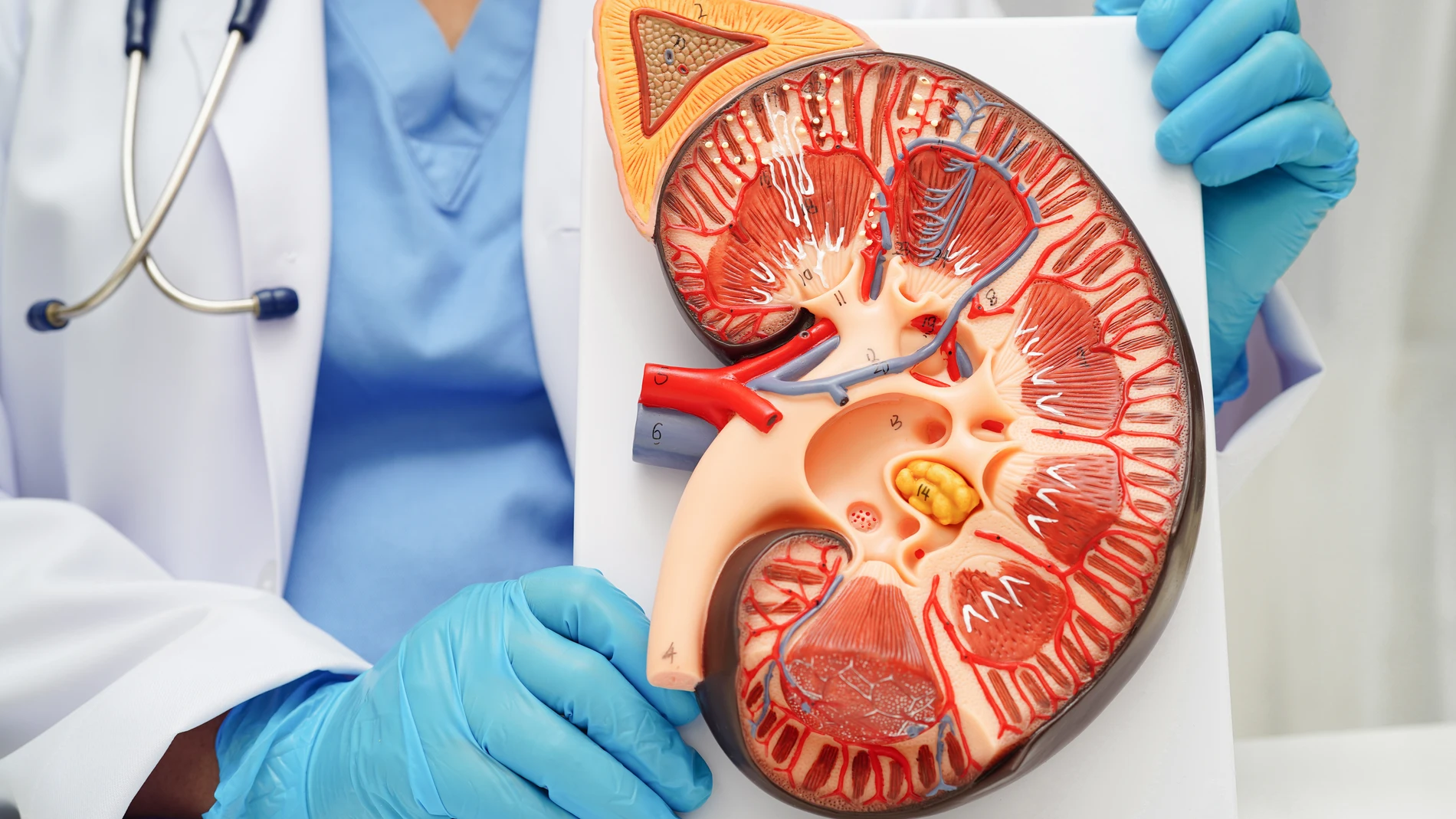 El cáncer de riñón es el octavo tumor más frecuente en España