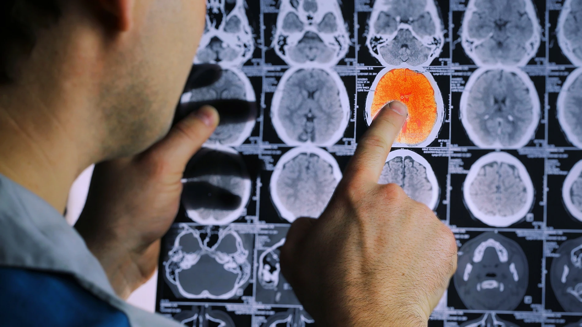 Oncología Tratamientos