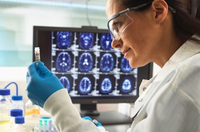 Una científica de España contribuye a dar un salto revolucionario en alzheimer Una científica de España contribuye a dar un salto revolucionario en alzheimer