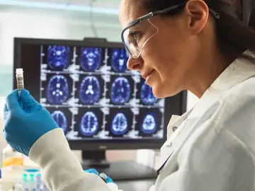 Una científica de España contribuye a dar un salto revolucionario en alzheimer científica alzheimer