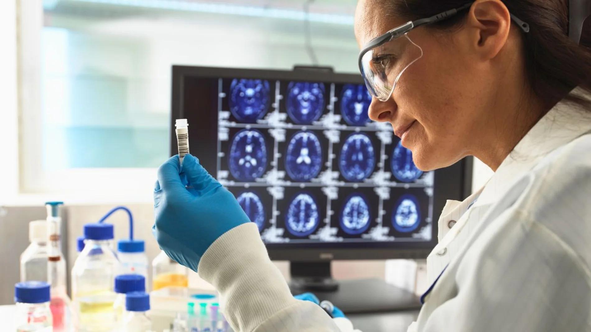 Una científica de España contribuye a dar un salto revolucionario en alzheimer