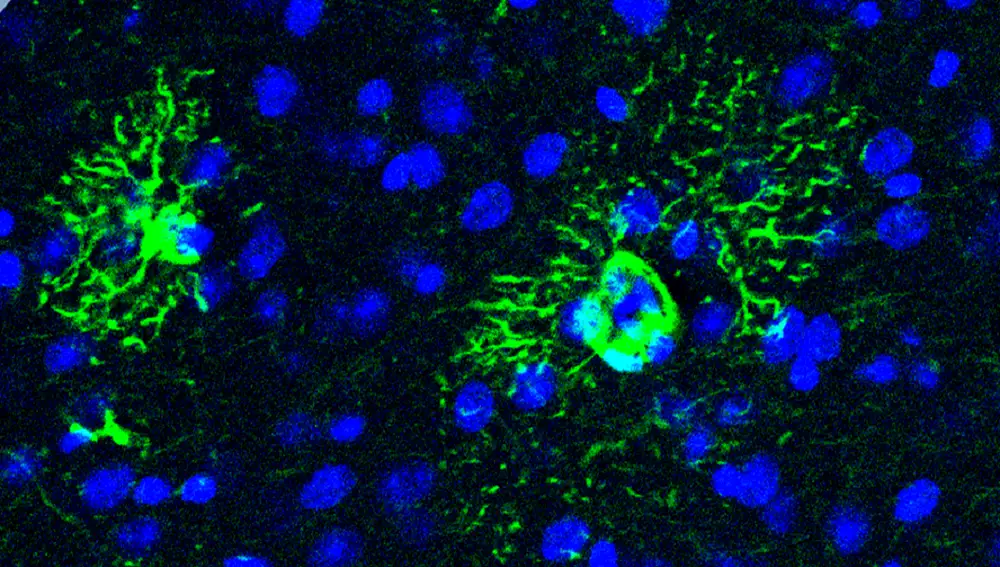 Descubren cómo una proteína provoca cambios tempranos en el cerebro que anticipan el alzhéimer