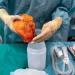 Reportaje sobre trasplante de &oacute;rganos. Recorrido de un transplante de ri&ntilde;&oacute;n en la Comunidad de Madrid. 