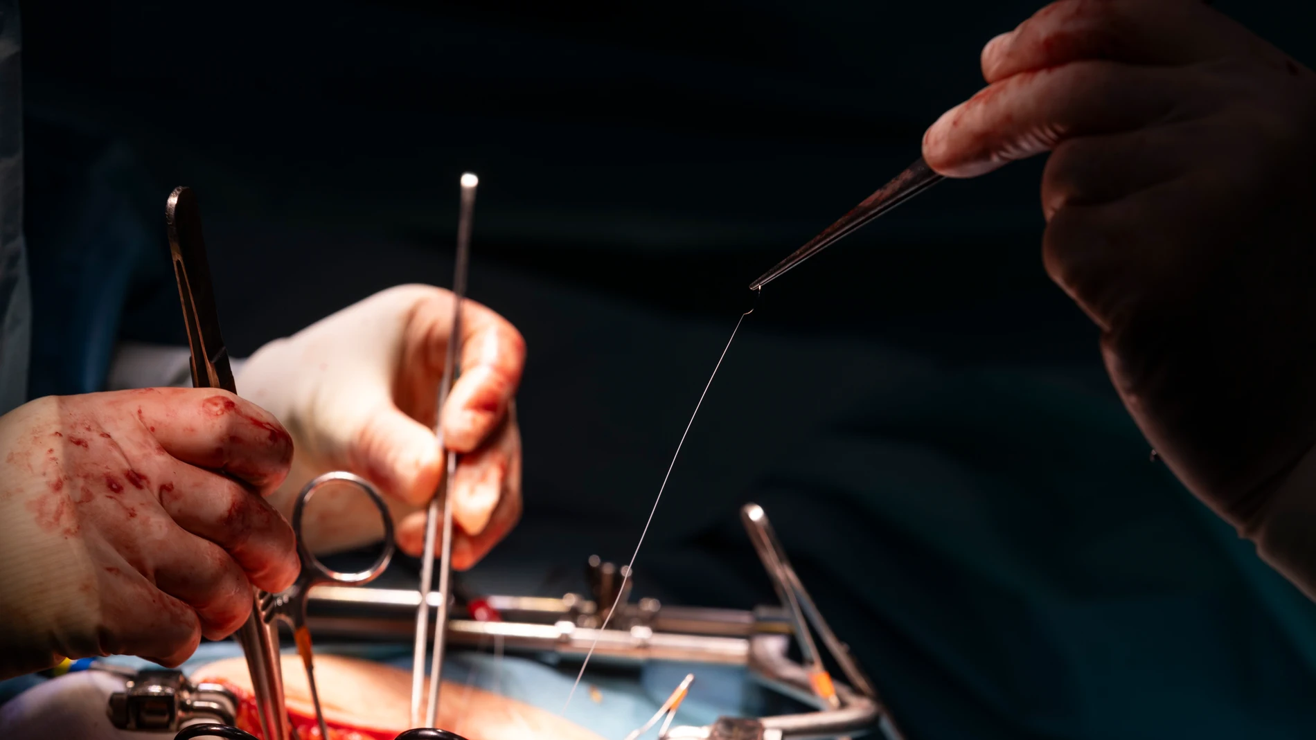 Reportaje sobre trasplante de órganos. Recorrido de un transplante de riñón en la Comunidad de Madrid.