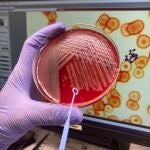 Imagen de una placa de Pseudomonas aeruginosa