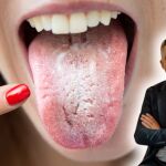 ¿Tienes marcas blancas en la lengua? Esto es lo que pueden estar indicándote según un experto