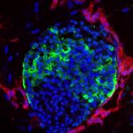 Los investigadores han ideado las condiciones adecuadas para cultivar islotes de células madre vascularizados. La imagen muestra la vasculatura (en rojo) fuertemente envuelta alrededor de las células productoras de insulina (en verde) en los islotes (en azul).