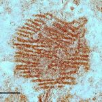 Detalle del punto rojo (izquierda) y la imagen dermatoglífica obtenida mediante el análisis multiespectral del punto rojo (derecha).