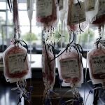 Esta patolog&iacute;a implica exceso de hierro en la sangre