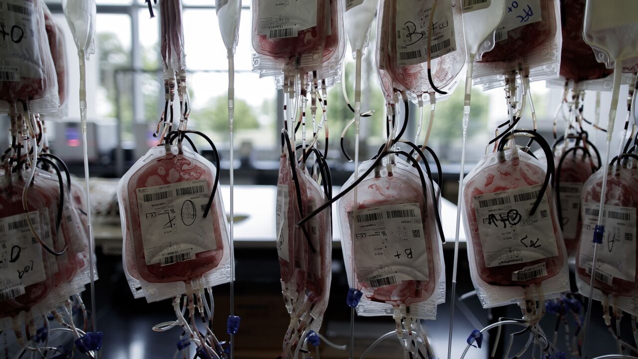 Avances en la «maldición celta»