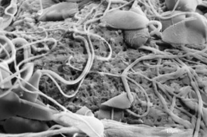 Espermatozoides sobre el óvulo Espermatozoides sobre el óvulo