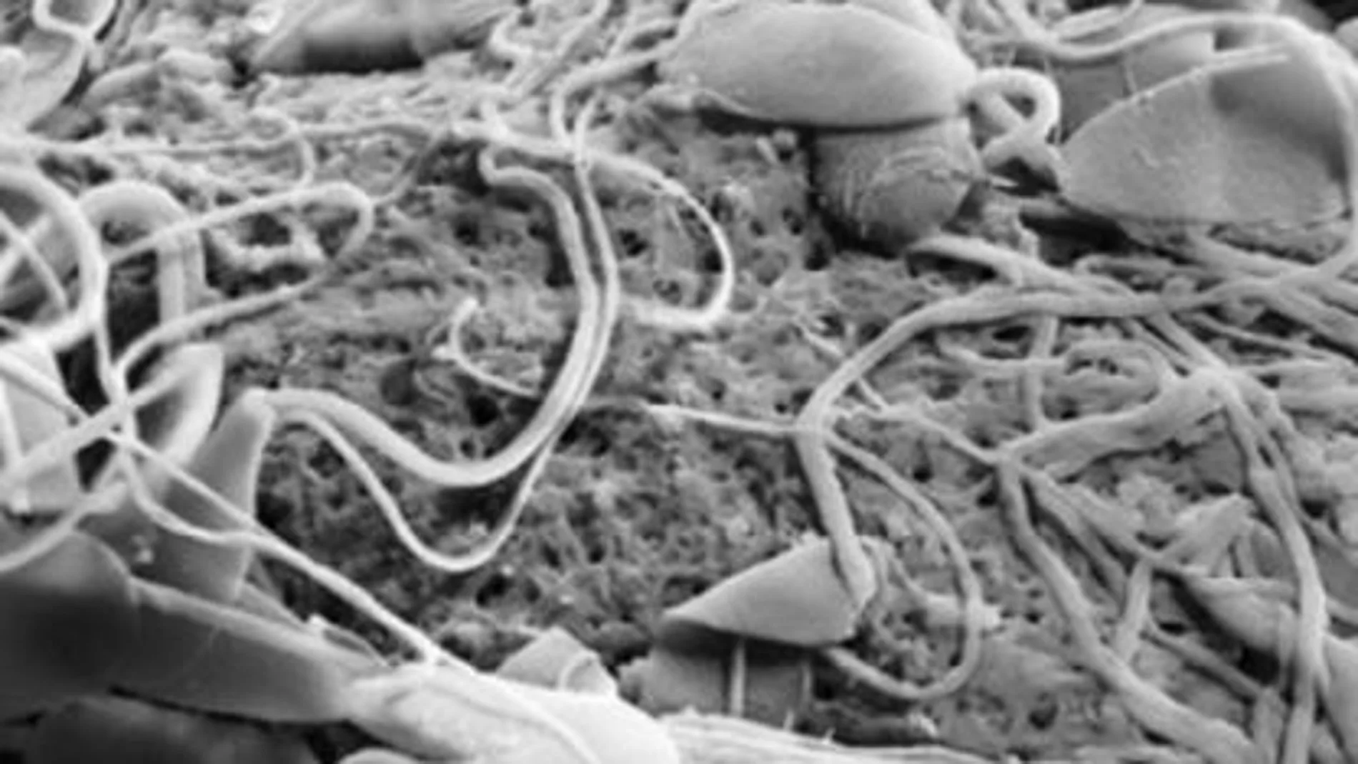 Espermatozoides sobre el óvulo