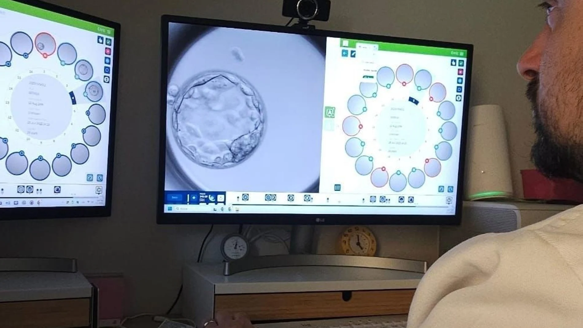 Un modelo de IA prevé con acierto del 82% el desarrollo de embriones con técnicas de reproducción asistida