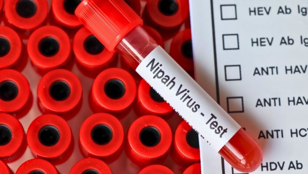 Virus Nipah