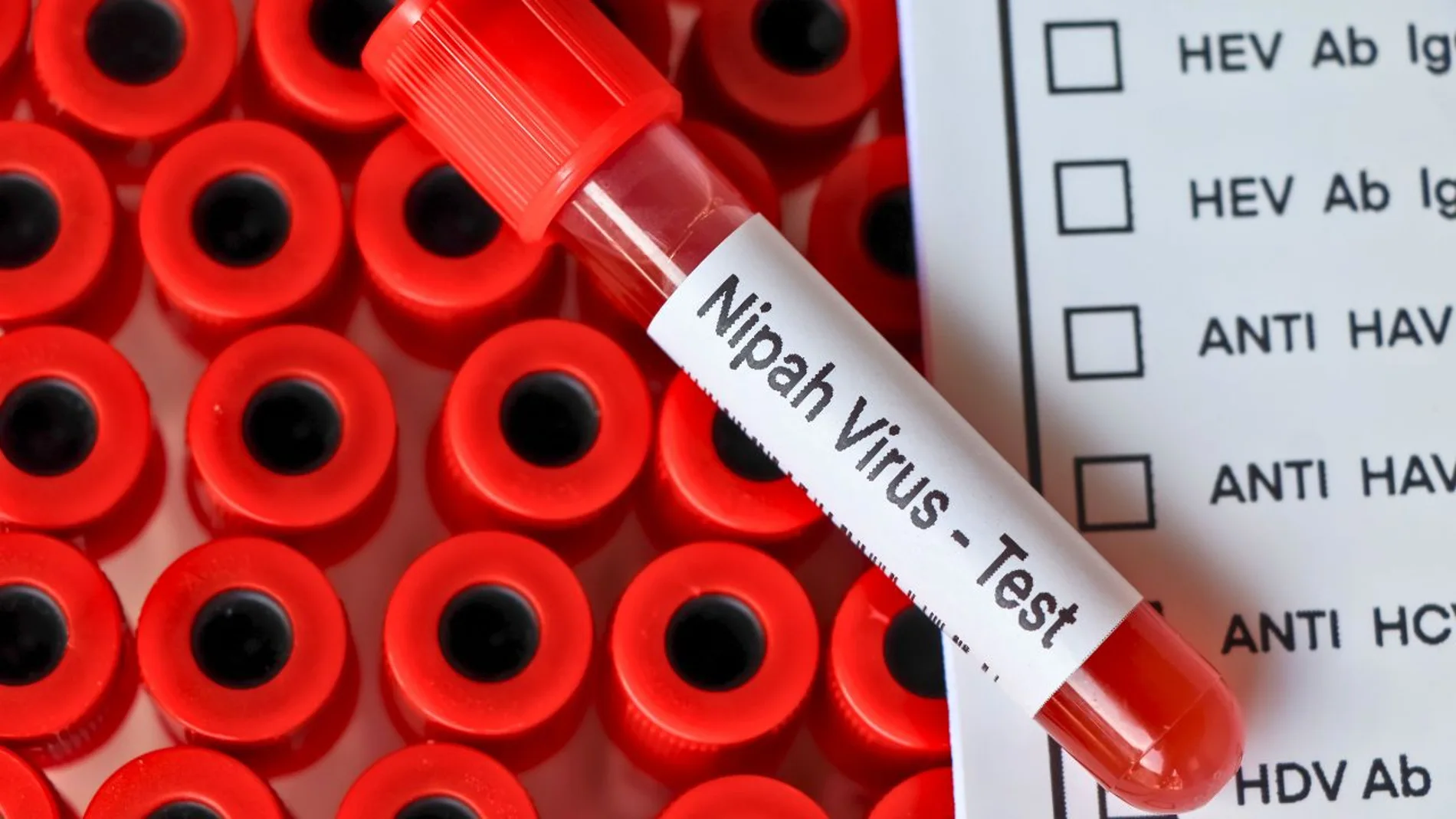 virus nipah