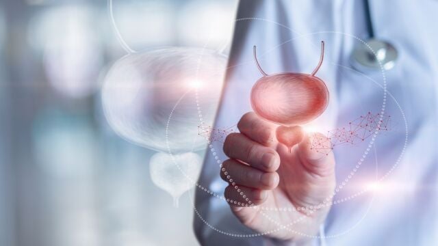 La incidencia de vejiga hiperactiva se sit&uacute;a en torno al 20%