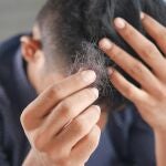 La proteína que podría cambiarlo todo: científicos descubren cómo reactivar el crecimiento del cabello de forma permanente