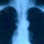 Tus pulmones sufren las consecuencias