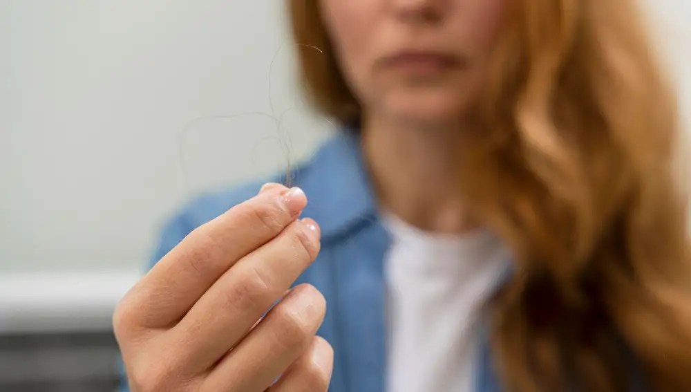 Caída del pelo