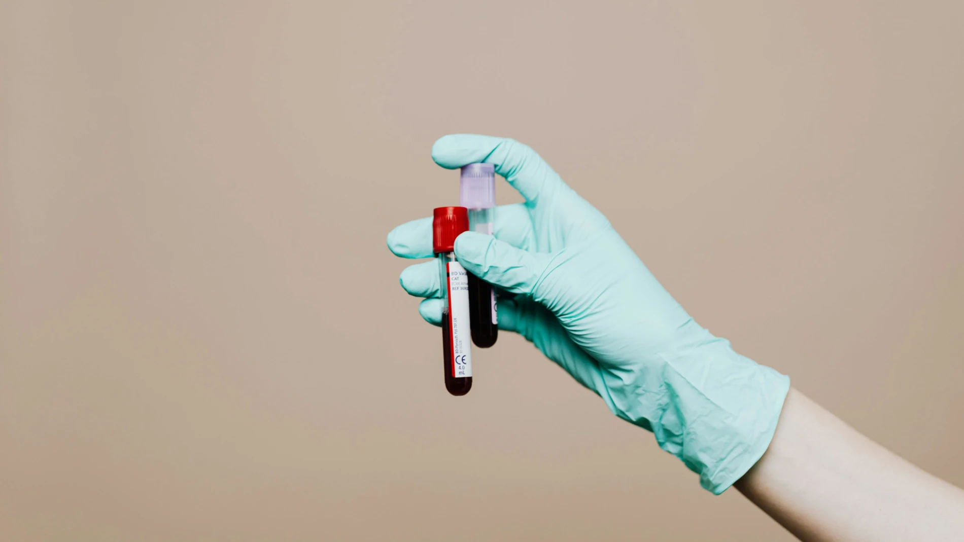 Tubos de ensayo con muestras sanguíneas