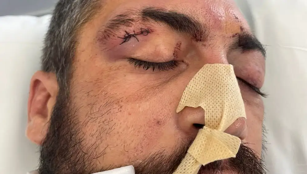 El autor del mordisco tuvo que ser reducido por los agentes e incluso ser intervenido