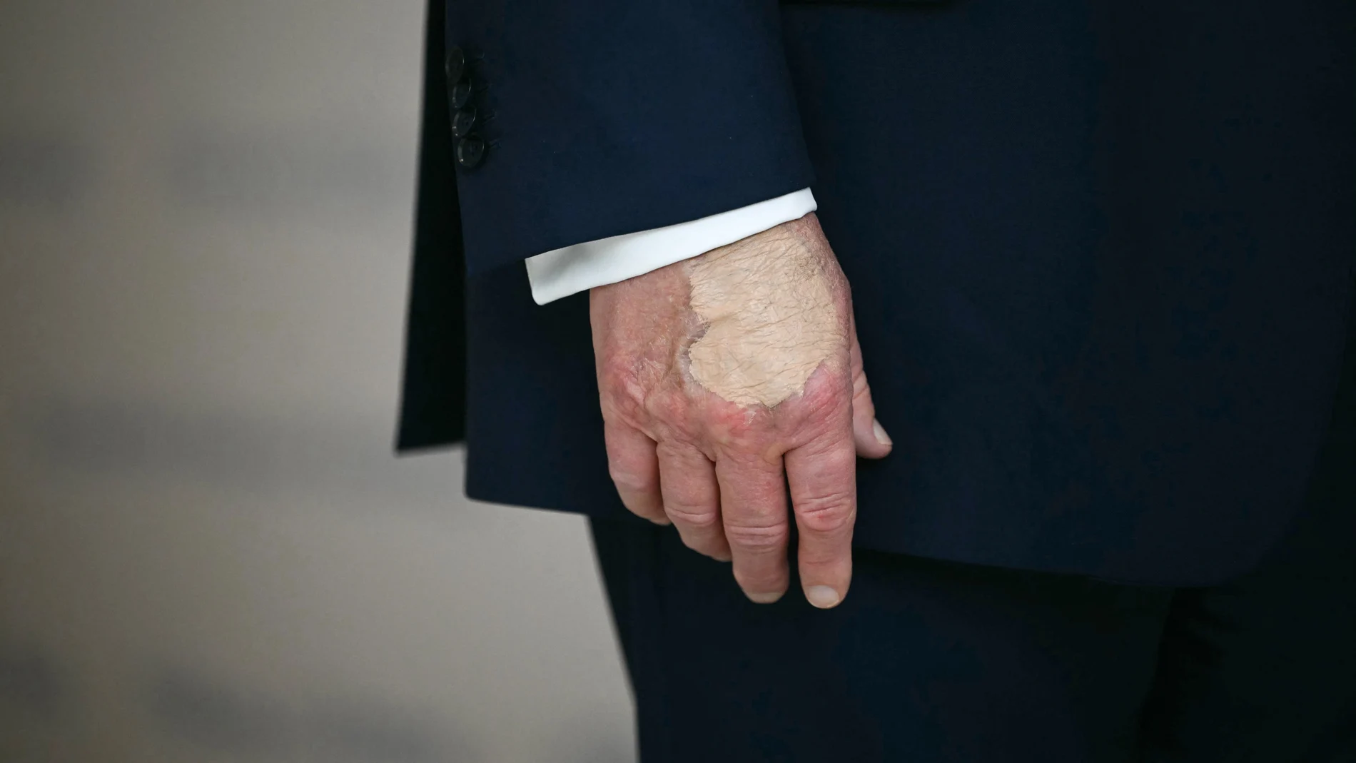 Especulación sobre la mano derecha de Donal Trump, cubierta con maquillaje